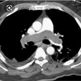 Cardiovascular imaging